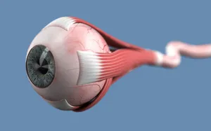 What is optic neuritis?